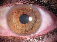 Ein Auge mit einer braunen Iris